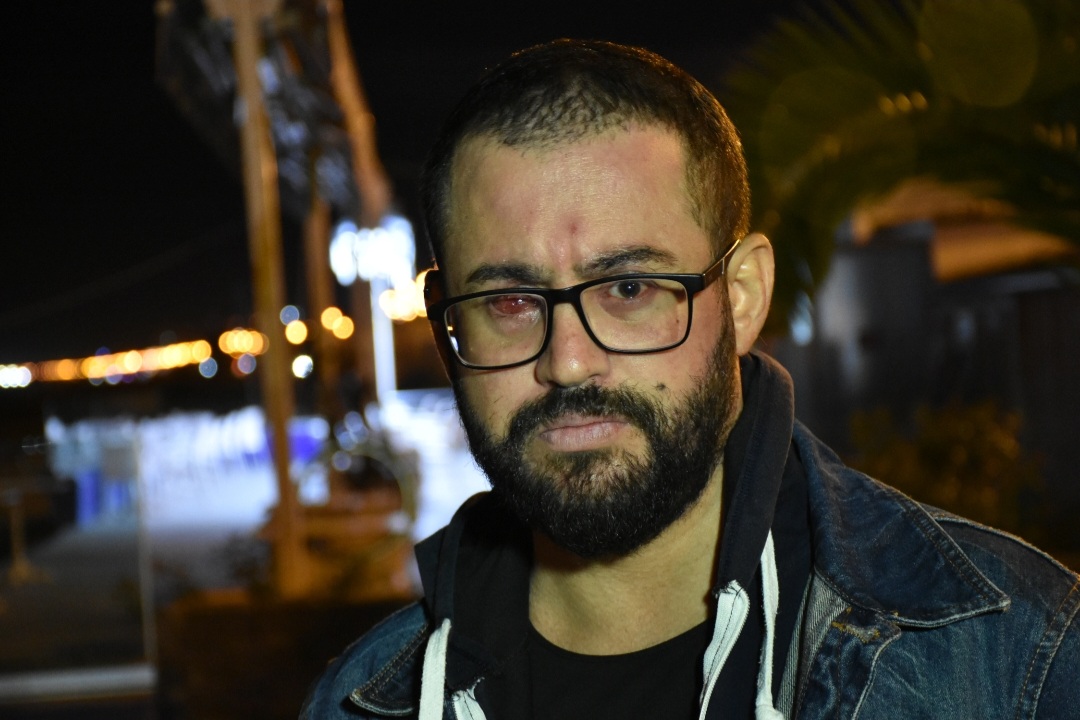 Darbedilen Diş Teknisyeni Sağ Gözünü Kaybetti