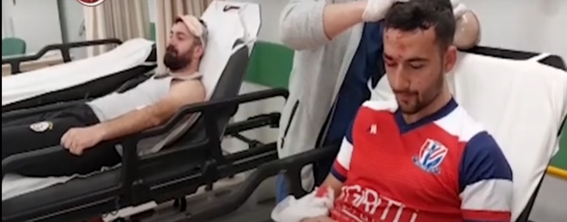 Kafa Topu İçin Havaya Yükselip Çarpışan Futbolcular Yaralandı