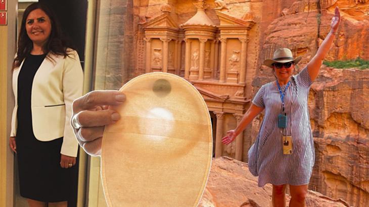 HABERLER:  9 yerinden kablo çıkıyordu! İlham oldu...